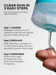 Extra Strength Acne Travel Trio